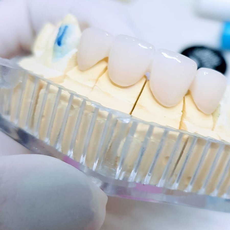 Smile Care Dental Clinic - Smile Care Dental Clinic